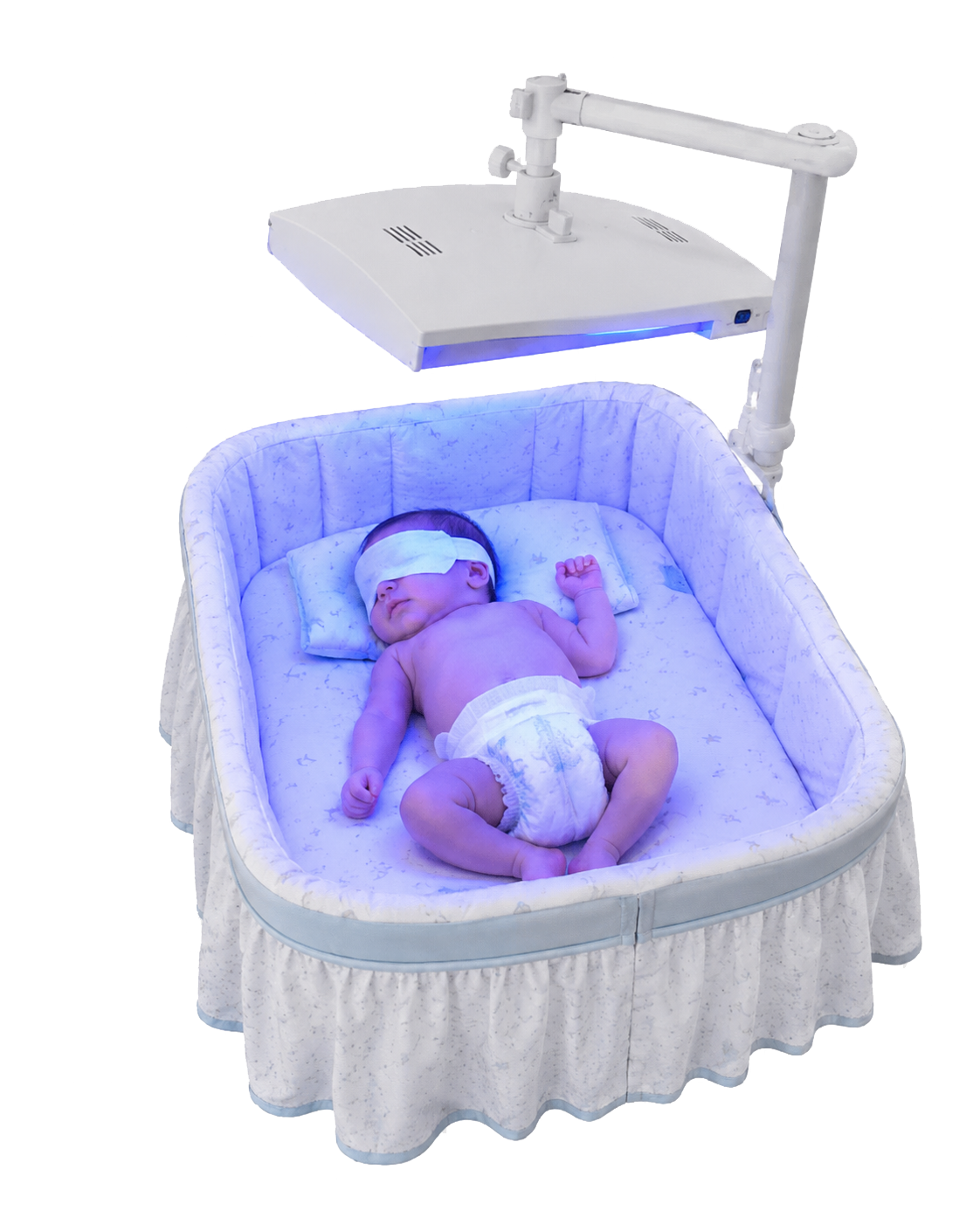 Recém-nascido recebendo fototerapia neonatal domiciliar com proteção ocular